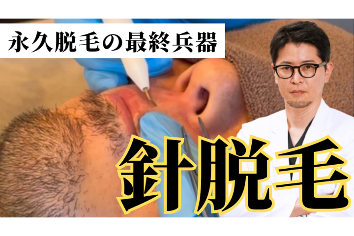 YouTube【白髪・タトゥー・日焼けOK】絶縁針脱毛｜痛み対策・麻酔まで徹底サポート