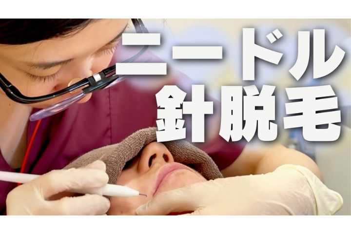 YouTube【シュラフ石田】看護師まい | ニードル脱毛施術の様子