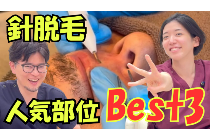 YouTube【医師解説】絶縁針脱毛で男性に人気の部位ランキングTOP3